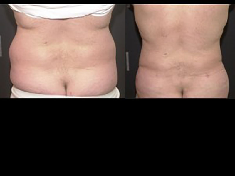 muffin top before and after men